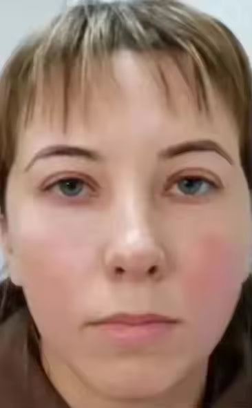 Eye Bag Removal Cream