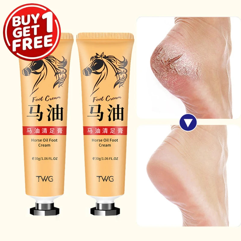 Ma You Qing Moisturizing Foot Cream | Deep Hydration for Dry Hands & Feet