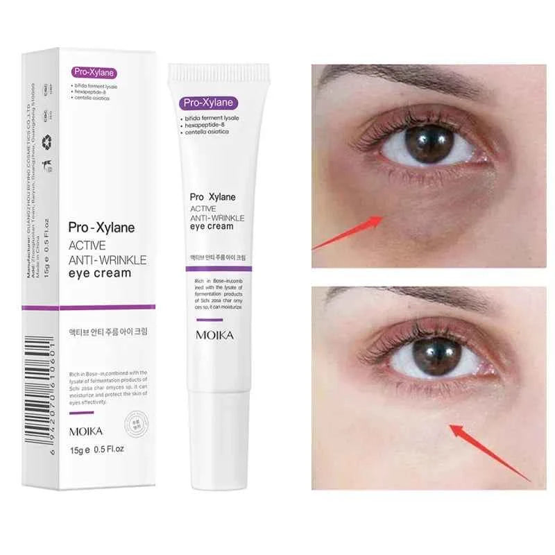 Eye Bag Removal Cream